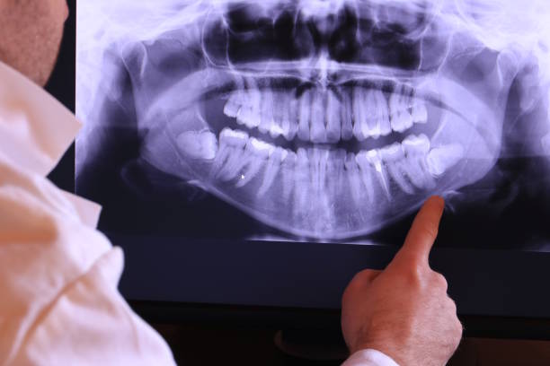 Best Emergency Treatment for Dental Infections or Abscesses in Genoa, OH