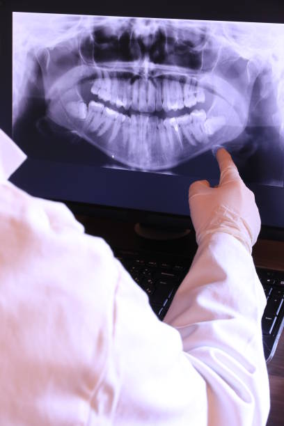 Best Emergency Gum Treatment in Genoa, OH