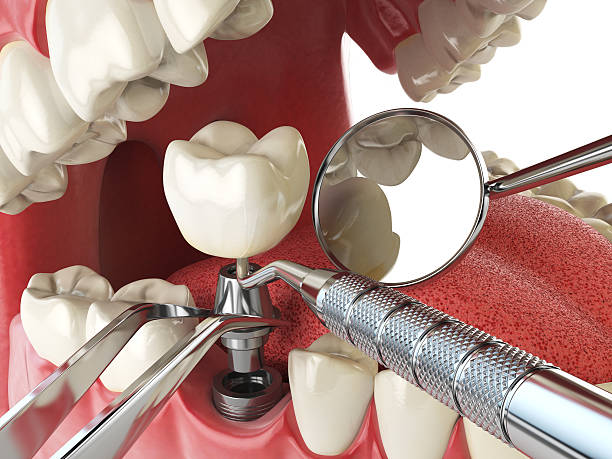 Best Emergency Denture Repair in Genoa, OH
